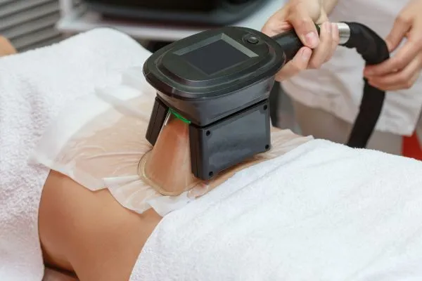 Image of person having fat freezing treatment to help weight gain Isleworth