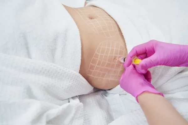 image of fat dissolving injections on love handles to help combat weight gain Isleworth