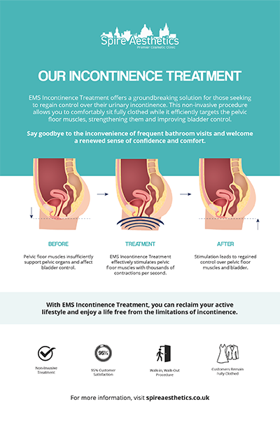 image to show how EMS treatment works for female urinary incontinence Isleworth