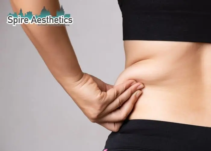 Image of woman pinching fat on their hips Isleworth. Fat Freezing treatment