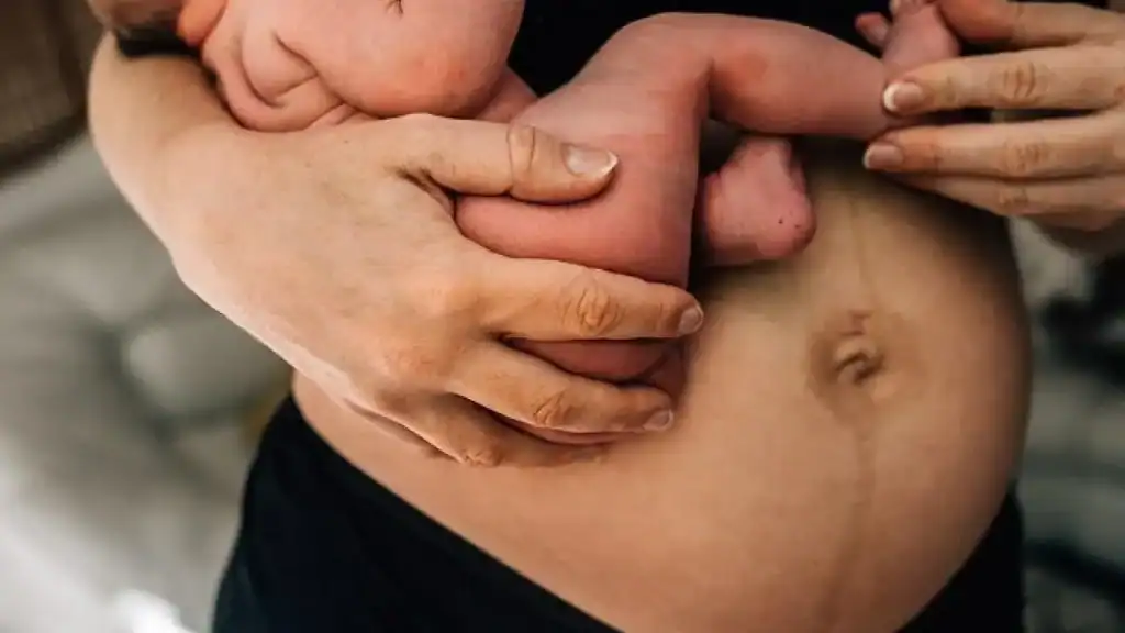 Why Is My Stomach Still Big After Pregnancy Isleworth?